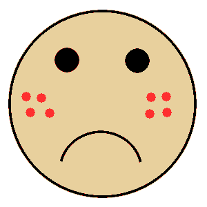 acne_cartoon_face