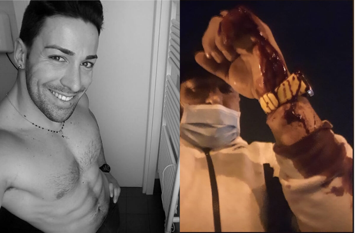 Temptation Island panico: ex concorrente accoltellato dalla fidanzata