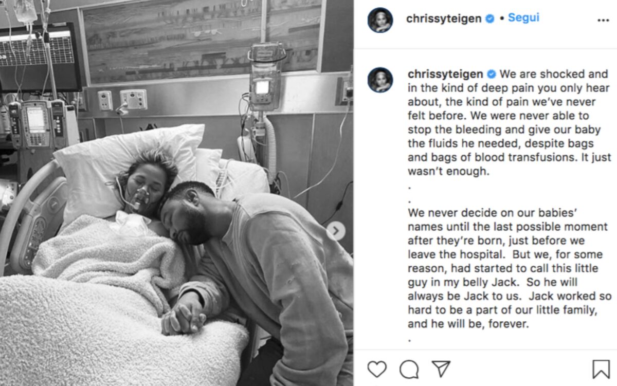 Chrissy Tigen: ancora sotto schock dopo l’aborto