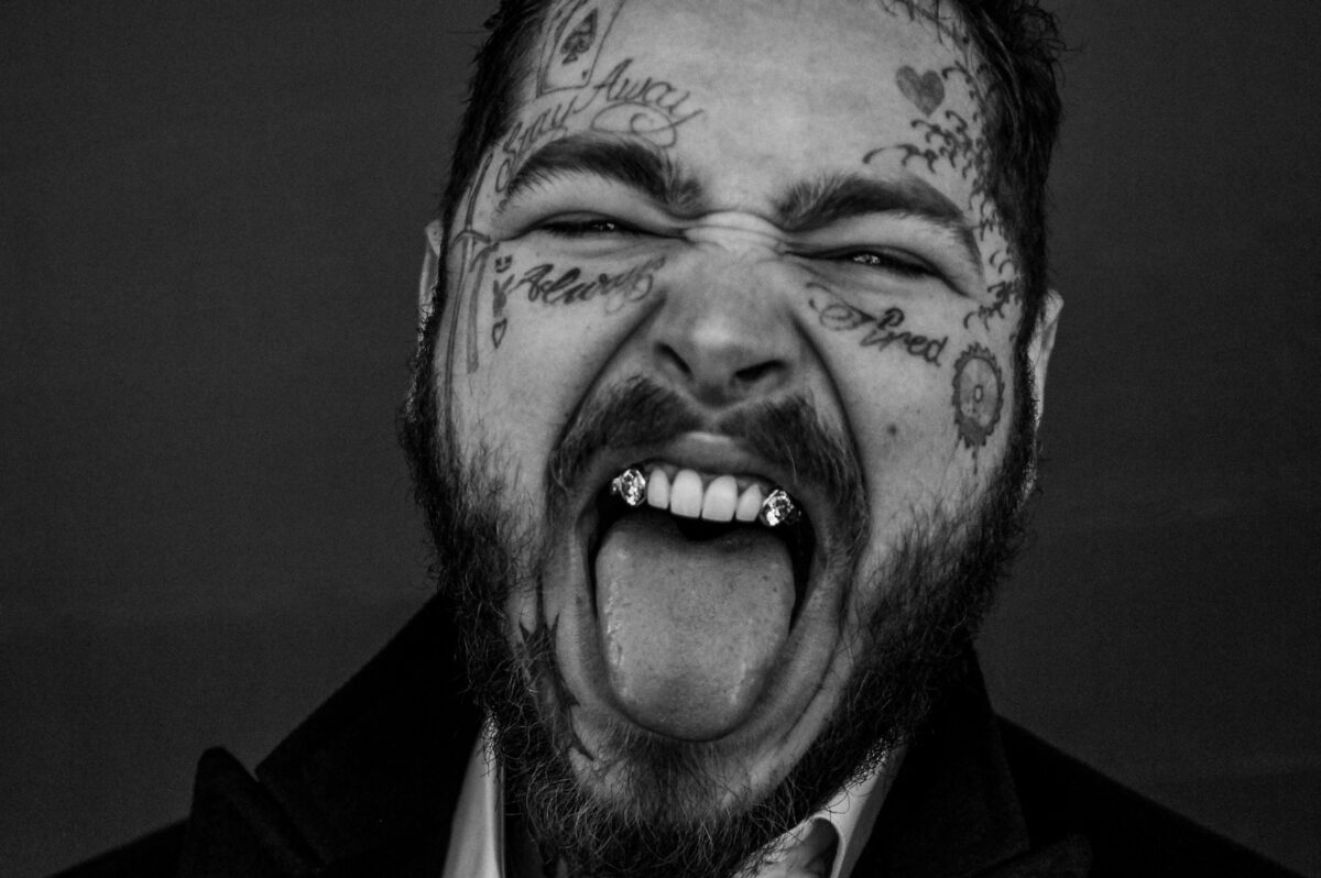Post Malone: il suo sorriso vale 1, 6 milioni