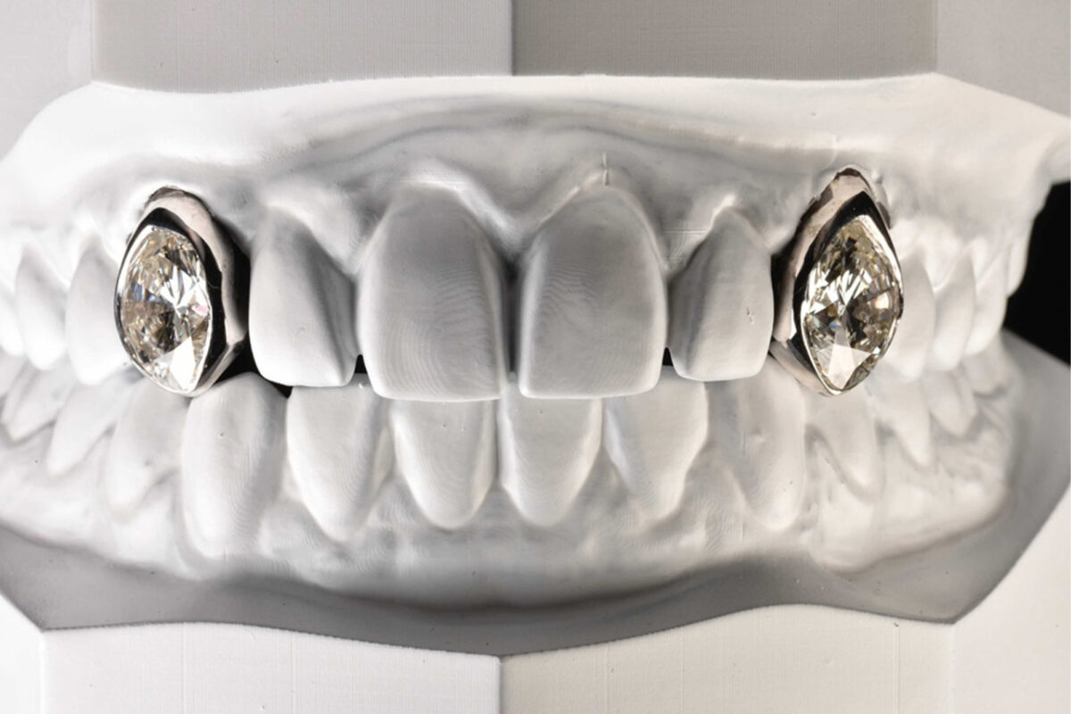 post-malone-teeth-001 post-malone-teeth-001