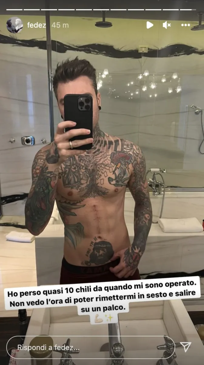 (19:30) Fedez dopo l’intervento “Ho perso 10 chili” (19:30) Fedez dopo l’intervento “Ho perso 10 chili”
