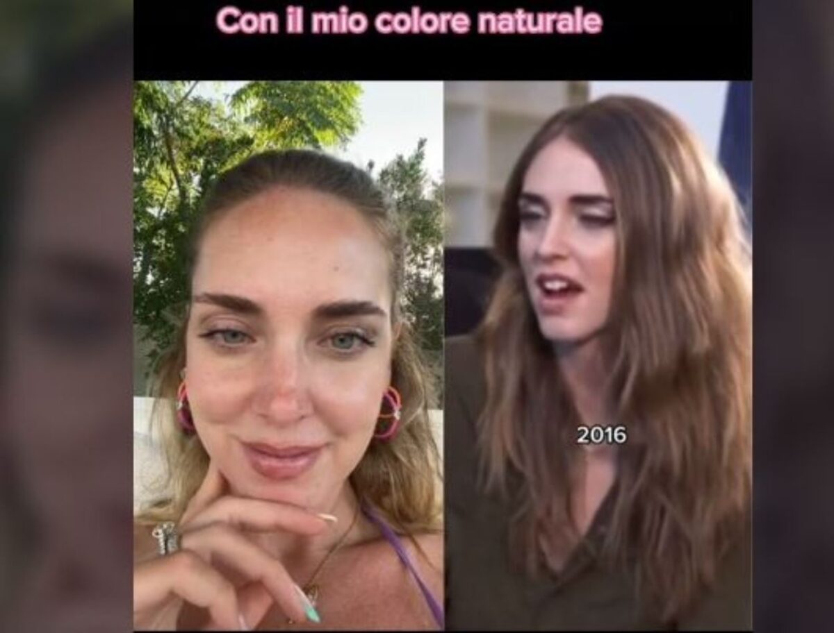Chiara Ferragni, la trasformazione: &egrave; migliorata dopo…